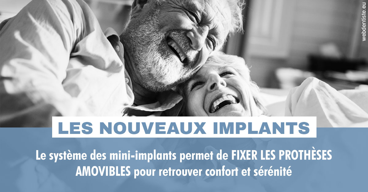https://dr-lenoble-traore-marie-madeleine.chirurgiens-dentistes.fr/Les nouveaux implants 2