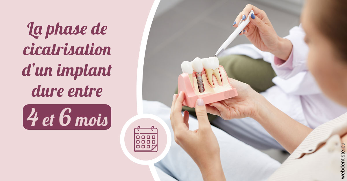 https://dr-lenoble-traore-marie-madeleine.chirurgiens-dentistes.fr/Cicatrisation implant 2