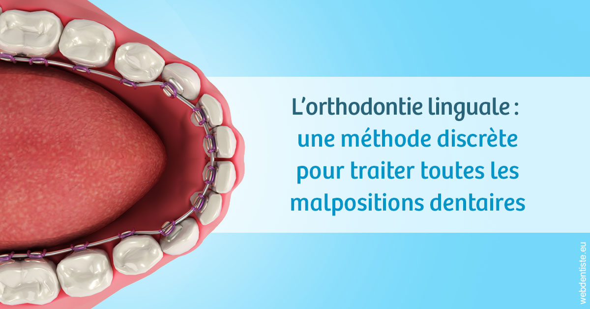 https://dr-lenoble-traore-marie-madeleine.chirurgiens-dentistes.fr/L'orthodontie linguale 1