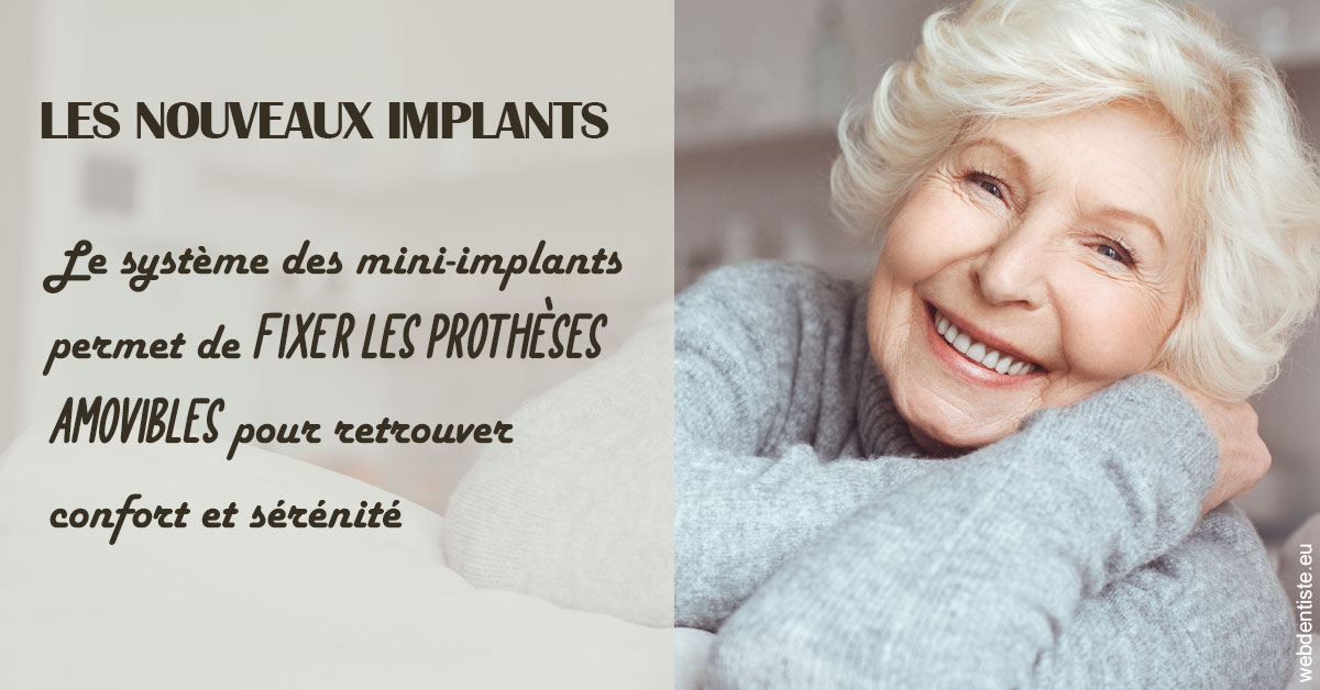 https://dr-lenoble-traore-marie-madeleine.chirurgiens-dentistes.fr/Les nouveaux implants 1