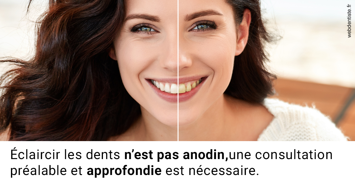 https://dr-lenoble-traore-marie-madeleine.chirurgiens-dentistes.fr/Le blanchiment 2