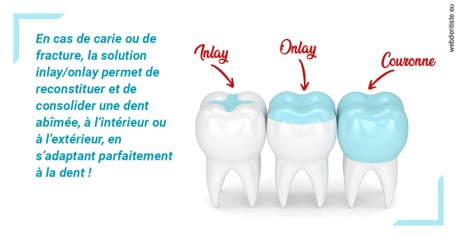 https://dr-lenoble-traore-marie-madeleine.chirurgiens-dentistes.fr/L'INLAY ou l'ONLAY