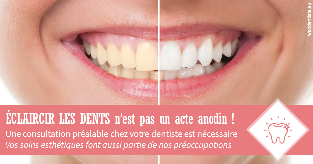 https://dr-lenoble-traore-marie-madeleine.chirurgiens-dentistes.fr/Eclaircir les dents 1