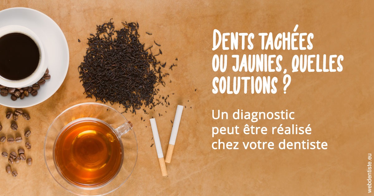 https://dr-lenoble-traore-marie-madeleine.chirurgiens-dentistes.fr/Dents tachées 2