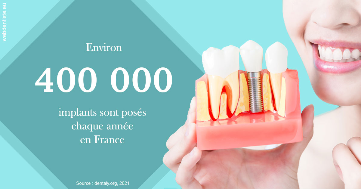 https://dr-lenoble-traore-marie-madeleine.chirurgiens-dentistes.fr/Pose d'implants en France 2